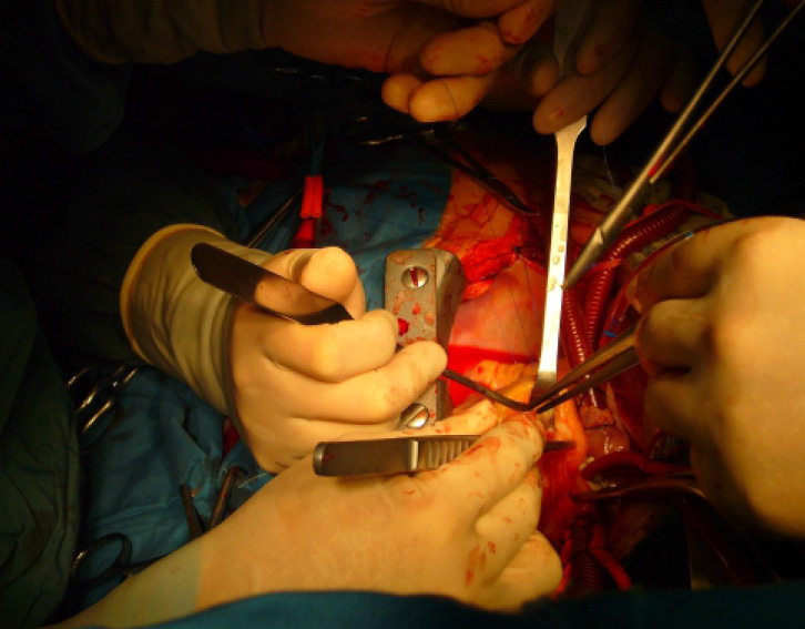 1517378559124095.jpg shoushu.jpg